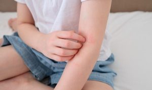 Çocuklarda ‘Alerjik Hastalıklar’ Hakkında Doğru Sanılan 8 Hatalı Bilgi!